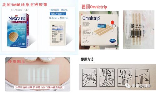 術后祛疤減張產品 減張器與減張貼相關問題匯總解答
